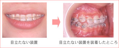 目立たない装置